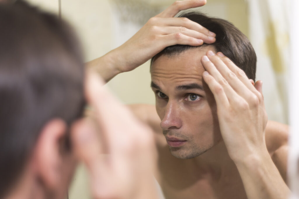 Hair Fall in Men: Causes, Early Signs & Effective Treatments in Kondapur, Hyderabad