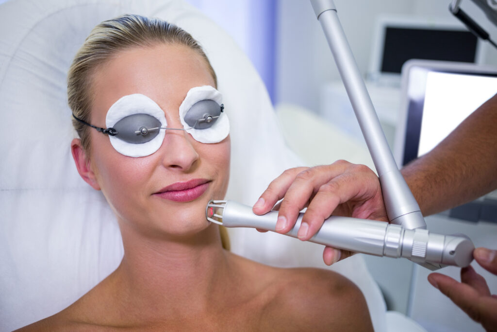 CO2 laser treatment